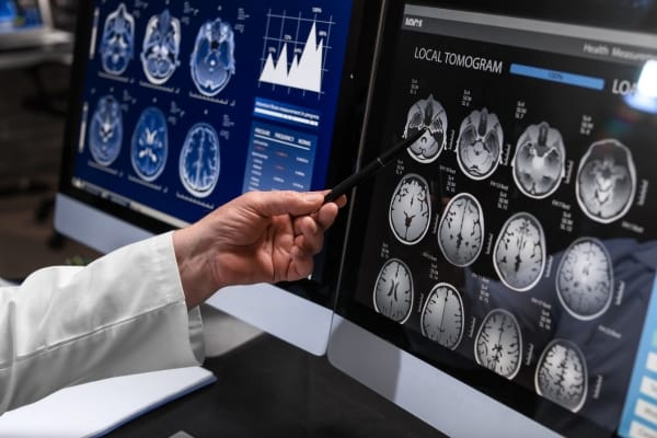 Neurology